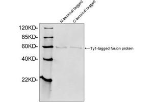 Western blot analysis of Ty1 tagged fusion proteins expressed in E. (Ty1 Tag antibody)
