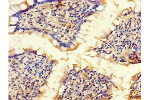 Immunohistochemistry of paraffin-embedded human small intestine tissue using ABIN7145600 at dilution of 1:100 (BLOC1S1 antibody  (AA 1-153))