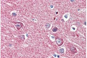 Human Brain, Cortex (formalin-fixed, paraffin-embedded) stained with HK1 antibody ABIN364333 at 5 ug/ml followed by biotinylated anti-mouse IgG secondary antibody ABIN481714, alkaline phosphatase-streptavidin and chromogen. (Hexokinase 1 antibody  (AA 1-917))