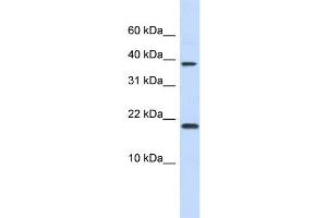 WB Suggested Anti-CHRAC1 Antibody Titration:  0. (CHRAC1 antibody  (N-Term))