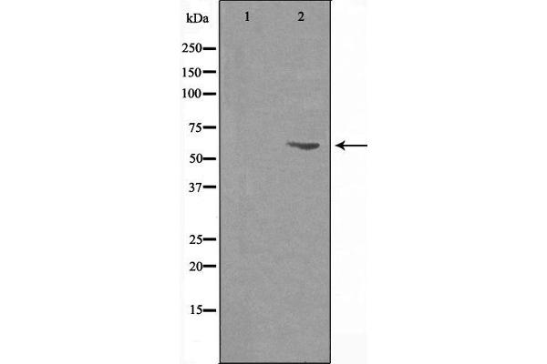 CYP27A1 antibody  (C-Term)