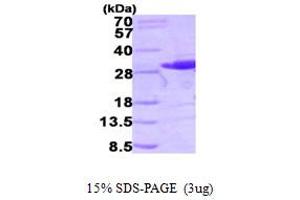 SDS-PAGE (SDS) image for V-Ral Simian Leukemia Viral Oncogene Homolog B (Ras Related, GTP Binding Protein) (Ralb) (AA 1-203) protein (His tag) (ABIN667855) (RALB Protein (AA 1-203) (His tag))