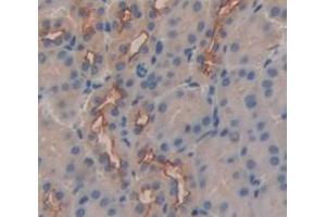 Figure. (ADAP2 antibody  (AA 49-361))