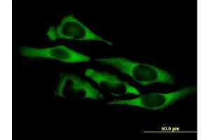 Immunofluorescence of purified MaxPab antibody to QARS on HeLa cell.