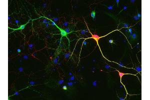 Indirect immunostaining of methanol fixed rat hippocampus neurons with anti-calretinin (dilution 1 : 500; red) and mouse anti-MAP 2 (, dilution 1 : 1000; green).