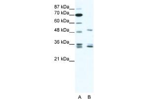 WB Suggested Anti-ZNF488 Antibody Titration:  1. (ZNF488 antibody  (C-Term))