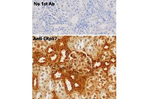 Immunohistochemistry (IHC) image for anti-Protein Disulfide Isomerase Family A, Member 3 (PDIA3) (C-Term) antibody (ABIN1440038) (PDIA3 antibody  (C-Term))