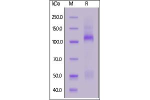 Mouse IGF-I R, His Tag on  under reducing (R) condition. (IGF1R Protein (AA 31-936) (His tag))