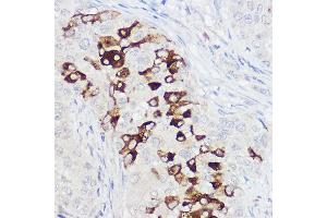 Immunohistochemistry (IHC) image for anti-Polymeric Immunoglobulin Receptor (PIGR) (AA 661-764) antibody (ABIN6145618)