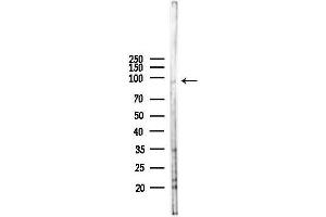 anti-ElaC Homolog 2 (ELAC2) (N-Term) antibody