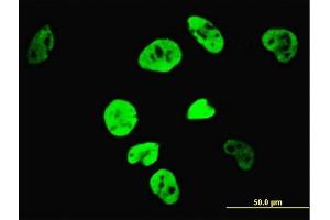 Immunofluorescence of monoclonal antibody to TCF7L2 on HeLa cell. (TCF7L2 antibody  (AA 490-596))