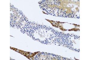 Immunohistochemistry of paraffin-embedded Rat testis using FMOD Polyclonal Antibody at dilution of 1:100 (20x lens). (Fibromodulin antibody)