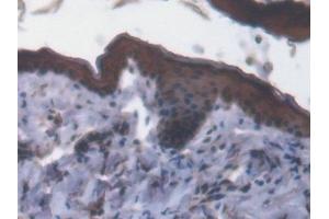 Detection of GLRX3 in Mouse Skin Tissue using Polyclonal Antibody to Glutaredoxin 3 (GLRX3)