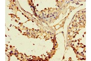 Immunohistochemistry of paraffin-embedded human testis tissue using ABIN7151860 at dilution of 1:100 (EPH Receptor B2 antibody  (AA 261-465))