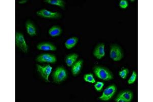 Immunofluorescent analysis of A549 cells using ABIN7174020 at dilution of 1:100 and Alexa Fluor 488-congugated AffiniPure Goat Anti-Rabbit IgG(H+L) (Fgr antibody  (AA 11-72))