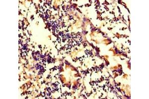 Immunohistochemistry of paraffin-embedded human appendix tissue using ABIN7175714 at dilution of 1:100 (WDFY4 antibody  (AA 1-322))