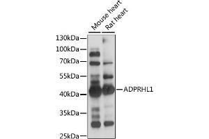 Western blot analysis of extracts of various cell lines, using  antibody (ABIN7265500) at 1:1000 dilution. (ADPRHL1 antibody  (AA 80-280))