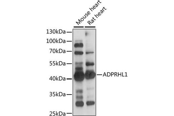 ADPRHL1 Antikörper  (AA 80-280)