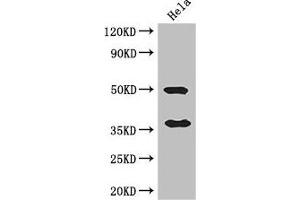 Western Blot Positive WB detected in: Hela whole cell lysate All lanes: AKR1B1 antibody at 3 μg/mL Secondary Goat polyclonal to rabbit IgG at 1/50000 dilution Predicted band size: 36 kDa Observed band size: 36, 50 kDa (AKR1B1 antibody  (AA 114-230))