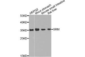 Western blot analysis of extract of various cells, using SRM antibody.