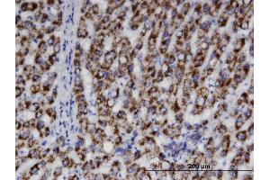 Immunoperoxidase of monoclonal antibody to ACAA1 on formalin-fixed paraffin-embedded human liver. (ACAA1 antibody  (AA 217-315))