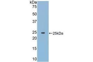Detection of Recombinant JAK2, Rat using Polyclonal Antibody to Janus Kinase 2 (JAK2) (JAK2 antibody  (AA 916-1103))