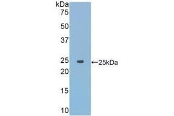 JAK2 anticorps  (AA 916-1103)
