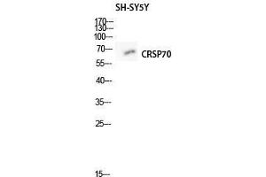 Western Blot (WB) analysis of SH-SY5Y lysis using CRSP70 antibody. (MED26 antibody  (N-Term))