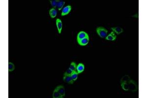 Immunofluorescence staining of PC-3 cells with ABIN7160318 at 1:133, counter-stained with DAPI. (ABCC5 antibody  (AA 455-566))