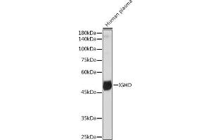 Western blot analysis of extracts of Human plasma, using IGHD Rabbit mAb (ABIN7267824) at 1:1000 dilution. (IgD antibody)