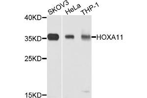 Western blot analysis of extracts of various cell lines, using HOXA11 antibody. (Homeobox A11 antibody)