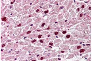 anti-Uracil-DNA Glycosylase (UNG) (C-Term) antibody