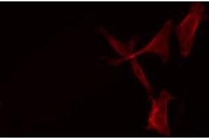 ABIN6276213 staining HeLa cells by IF/ICC. (SCTR antibody  (Internal Region))