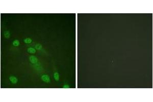 Immunofluorescence analysis of HeLa cells, using NF-kappaB p65 (Ab-310) Antibody. (NF-kB p65 antibody  (AA 275-324))