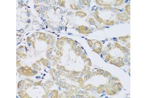 Immunohistochemistry of paraffin-embedded Human stomach using ATPIF1 Polyclonal Antibody at dilution of 1:100 (40x lens). (ATPase Inhibitory Factor 1 antibody)