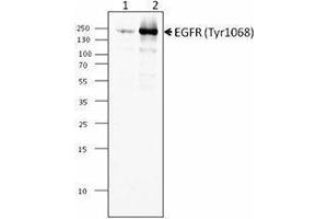 Western Blotting (WB) image for anti-Epidermal Growth Factor Receptor (EGFR) (pTyr1068) antibody (ABIN2666246) (EGFR antibody  (pTyr1068))