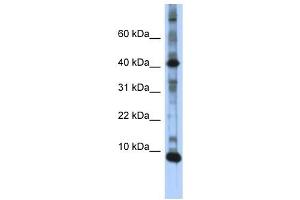 LSM6 antibody used at 1 ug/ml to detect target protein.