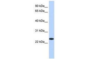 Image no. 1 for anti-Na+/K+ Transporting ATPase Interacting 4 (NKAIN4) (N-Term) antibody (ABIN6741227) (NKAIN4 antibody  (N-Term))