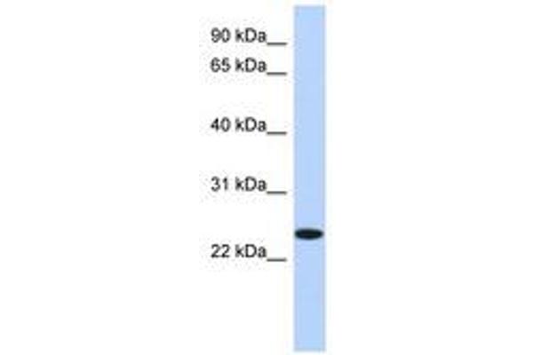 NKAIN4 抗体  (N-Term)