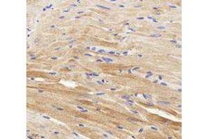 Immunohistochemistry analysis of paraffin-embedded mouse carditis using,CTNT (ABIN7076033) at dilution of 1: 400 (Cardiac Troponin T2 antibody)