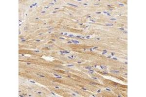 Immunohistochemistry analysis of paraffin-embedded mouse carditis using,CTNT (ABIN7076033) at dilution of 1: 400