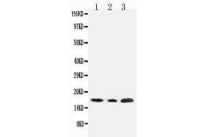 Anti-SDHC antibody, Western blotting Lane 1: Rat Liver Tissue Lysate Lane 2: HELA Tissue Lysate Lane 3: JURKAT Cell Lysate