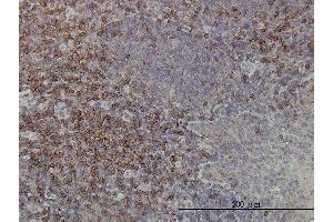 Immunoperoxidase of monoclonal antibody to PRKCA on formalin-fixed paraffin-embedded human tonsil. (PKC alpha antibody  (AA 563-672))