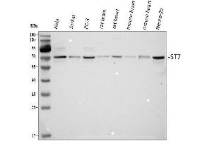 Western blot analysis of ST7 using anti-ST7 antibody (ABIN4886732). (ST7 antibody  (Middle Region))