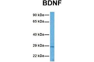 Host:  Rabbit  Target Name:  BDNF  Sample Tissue:  Human ACHN  Antibody Dilution:  1. (BDNF antibody  (Middle Region))
