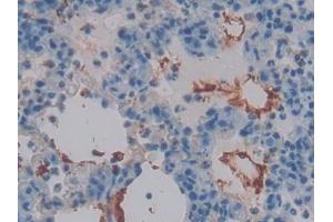 IHC-P analysis of Rat Lung Tissue, with DAB staining.