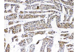 Immunohistochemistry (IHC) image for anti-Laminin, gamma 1 (LAMC1) (all Isoforms) antibody (ABIN5692889)