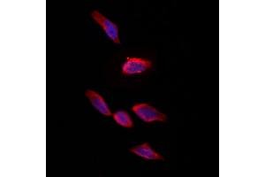 ABIN6261833 and ABIN6273246 staining Hela by IF/ICC. (FXR1 antibody  (Internal Region))