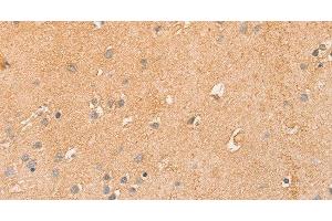 Immunohistochemistry of paraffin-embedded Human brain using CCL16 Polyclonal Antibody at dilution of 1:50 (CCL16 antibody)