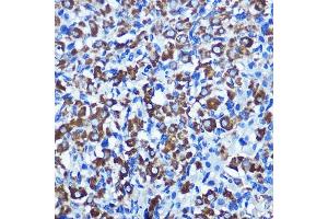 Immunohistochemistry of paraffin-embedded rat ovary using NEK2 Rabbit pAb  at dilution of 1:100 (40x lens). (NEK2 antibody  (C-Term))